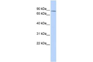 WB Suggested Anti-ZNF667 Antibody Titration:  0.