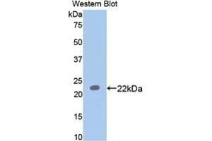 Detection of Recombinant PON1, Rat using Polyclonal Antibody to Paraoxonase 1 (PON1) (PON1 antibody  (AA 2-186))