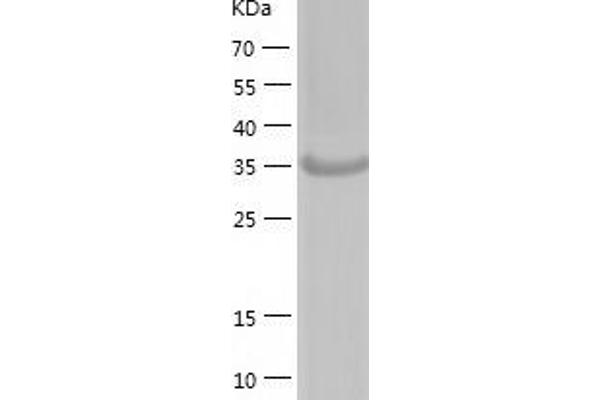 ACOT7 Protein (AA 1-370) (His tag)