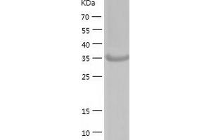 Western Blotting (WB) image for Acyl-CoA Thioesterase 7 (ACOT7) (AA 1-370) protein (His tag) (ABIN7121687) (ACOT7 Protein (AA 1-370) (His tag))