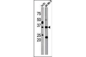 The anti-ICMT Pab (ABIN389122 and ABIN2839304) is used in Western blot to detect ICMT in T47D (left) and SK-BR-3 (right) tissue lysate (ICMT antibody  (C-Term))