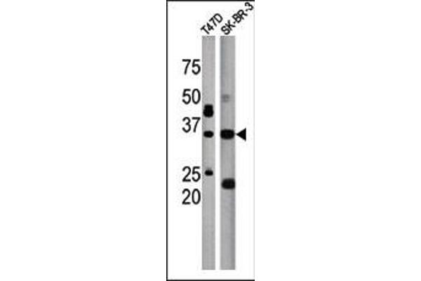 ICMT anticorps  (C-Term)