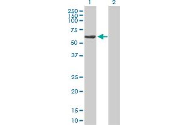 TBCE antibody  (AA 1-527)