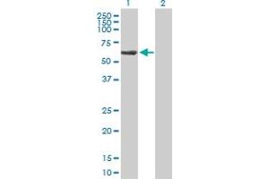 Western Blot analysis of TBCE expression in transfected 293T cell line by TBCE MaxPab polyclonal antibody.