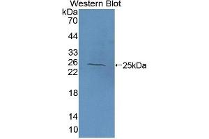 Detection of Recombinant NAGa, Human using Polyclonal Antibody to N-Acetylgalactosaminidase Alpha (NAGa) (NAGA antibody  (AA 18-217))