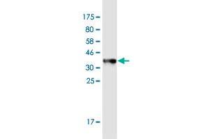 Western Blot detection against Immunogen (35. (Mammaglobin A antibody  (AA 1-93))