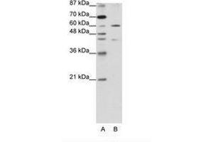 Image no. 1 for anti-Zinc Finger Protein 496 (ZNF496) (N-Term) antibody (ABIN202790) (ZNF496 antibody  (N-Term))