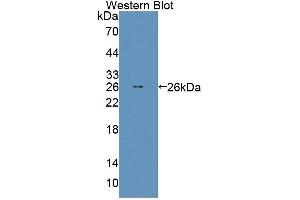 Detection of Recombinant ABCD2, Mouse using Polyclonal Antibody to ATP Binding Cassette Transporter D2 (ABCD2) (Abcd2 antibody  (AA 501-695))