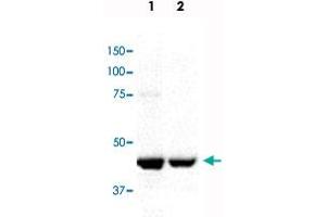 Western blot analysis in Lane 1: mitotic HeLa cell lysate and Lane 2: mitotic Jurkat cell lysate with CENPE monoclonal antibody, clone CENP-E. (CENPE antibody)