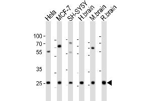 Western blot analysis of lysates from Hela, MCF-7, SH-SY5Y cell line, human brain, mouse brain, rat brain tissue (from left to right), using NTF3 Antibody (Center) (ABIN6242464 and ABIN6577625). (Neurotrophin 3 antibody  (AA 89-120))