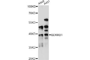 Western blot analysis of extracts of various cell lines, using BDKRB1 antibody (ABIN6290094) at 1:1000 dilution. (BDKRB1 antibody)