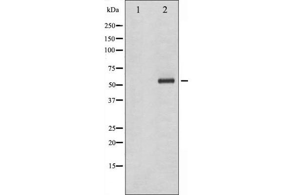 CHEK1 antibody  (pSer286)