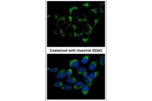 ICC/IF Image Immunofluorescence analysis of methanol-fixed A431, using CMG1, antibody at 1:500 dilution. (IFT74 antibody  (C-Term))
