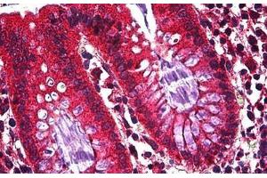 Human Colon, Epithelium: Formalin-Fixed, Paraffin-Embedded (FFPE) (Ghrelin antibody  (AA 1-118))