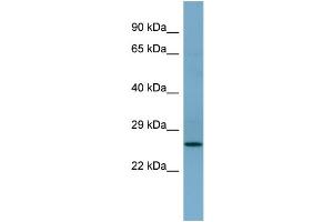 WB Suggested Anti-APIP  Antibody Titration: 0. (APIP antibody  (Middle Region))