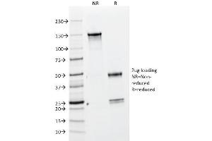 SDS-PAGE Analysis Purified BrdU Mouse Monoclonal Antibody (BRD469). (BrdU antibody)