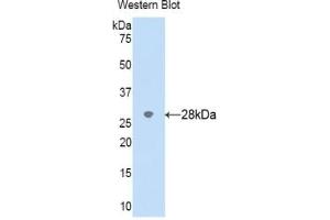 Detection of Recombinant CYP2D6, Human using Polyclonal Antibody to Cytochrome P450 2D6 (CYP2D6) (CYP2D6 antibody  (AA 236-472))