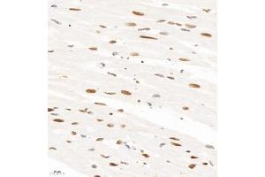 Immunohistochemistry analysis of paraffin-embedded rat heart using HNRNPM (ABIN7074247) at dilution of 1: 4000 (HnRNP M1-M4 antibody)