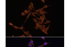 Immunofluorescence analysis of HeLa cells using UBE2J1 Polyclonal Antibody at dilution of 1:100. (UBE2J1 antibody)