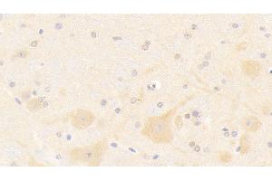 Detection of NOS1 in Mouse Cerebellum Tissue using Polyclonal Antibody to Nitric Oxide Synthase 1, Neuronal (NOS1) (NOS1 antibody  (AA 691-826))