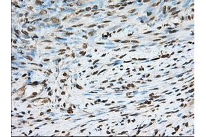 Immunohistochemical staining of paraffin-embedded Human Kidney tissue using anti-PDE4A mouse monoclonal antibody. (PDE4A antibody)