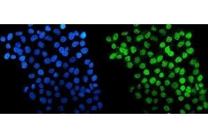IF analysis of HDAC5 using anti-HDAC5 antibody (ABIN7599922). (HDAC5 antibody  (AA 13-1107))