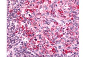 Anti-GPR65 antibody IHC of human lymph node. (GPR65 antibody  (Extracellular Domain))