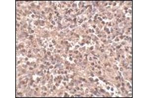 Immunohistochemistry: ATG5 antibody staining of Rat Spleen tissue lysate at 2 μg/ml (ATG5 antibody  (N-Term))