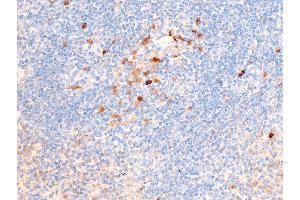 ABIN6267224 at 1/100 staining mouse spleen tissue sections by IHC-P. (CHEK1 antibody  (pSer317))