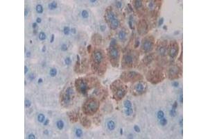 Used in DAB staining on fromalin fixed paraffin- embedded Kidney tissue (APBA3 antibody  (AA 261-506))