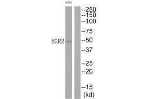 Western blot analysis of extracts from K562 cells, using EGR2 antibody. (EGR2 antibody  (C-Term))