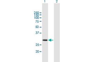 Western Blot analysis of ZBED2 expression in transfected 293T cell line by ZBED2 MaxPab polyclonal antibody. (ZBED2 antibody  (AA 1-218))