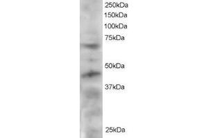 ABIN184696 staining (2 ug/ml) of HeLa lysate (RIPA buffer, 30 ug total protein per lane). (TRF1 antibody  (C-Term))