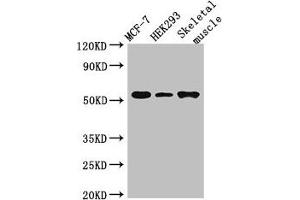 Western Blot Positive WB detected in: MCF-7 whole cell lysate, HEK293 whole cell lysate, Mouse skeletal muscle tissue All lanes: RMND1 antibody at 3 μg/mL Secondary Goat polyclonal to rabbit IgG at 1/50000 dilution Predicted band size: 52, 28, 24 kDa Observed band size: 52 kDa (RMND1 antibody  (AA 35-160))