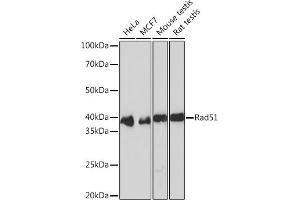 Western blot analysis of extracts of various cell lines, using Rad51 Rabbit mAb (ABIN3016792, ABIN3016793, ABIN1682438 and ABIN1682439) at 1:1000 dilution. (RAD51 antibody)