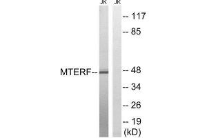 Western Blotting (WB) image for anti-Mitochondrial Transcription Termination Factor (MTERF) (Internal Region) antibody (ABIN1852304)