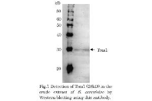 Western Blotting (WB) image for anti-CD248 Molecule, Endosialin (CD248) (full length) antibody (ABIN2452152) (CD248 antibody  (full length))