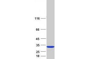 Validation with Western Blot