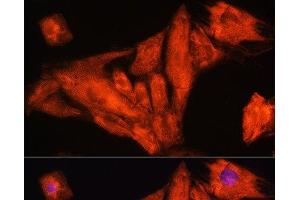 Immunofluorescence analysis of H9C2 cells using RIG-I / DDX58 Polyclonal Antibody at dilution of 1:100. (DDX58 antibody)
