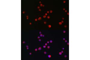 Immunofluorescence analysis of Neuro-2a cells using ALK antibody  at dilution of 1:200. (ALK antibody  (AA 19-300))