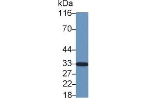 Detection of CDKN1B in Cavia Cerebrum lysate using Polyclonal Antibody to Cyclin Dependent Kinase Inhibitor 1B (CDKN1B) (CDKN1B antibody  (AA 2-197))