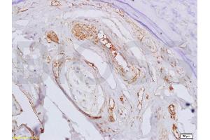 Formalin-fixed and paraffin embedded rat bone marrow labeled with Rabbit Anti BMPR1A/CD292 Polyclonal Antibody, Unconjugated (ABIN687547) at 1:200 followed by conjugation to the secondary antibody and DAB staining (BMPR1A antibody  (AA 101-200))