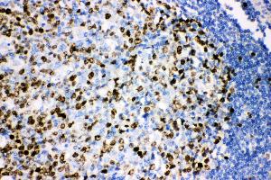 Anti-Ki67 Picoband antibody,  IHC(P): Human Tonsil Tissue (Ki-67 antibody  (AA 2860-3256))