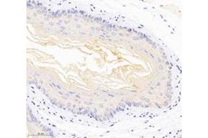 Immunohistochemistry analysis of paraffin-embedded mouse esophagus using,DSP (ABIN7073719) at dilution of 1: 1000 (Desmoplakin antibody)