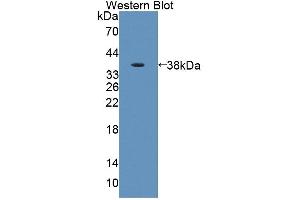 Figure. (AADAT antibody  (AA 99-425))