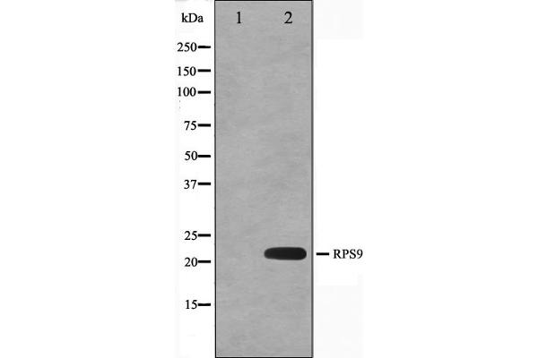 RPS9 antibody  (Internal Region)