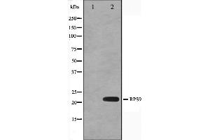Western blot analysis on HeLa cell lysate using RPS9 Antibody,The lane on the left is treated with the antigen-specific peptide.
