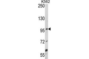 Western Blotting (WB) image for anti-Unc-5 Homolog C (C. Elegans) (Unc5c) antibody (ABIN3002880) (Unc5c antibody)