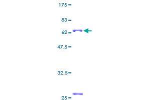 MAB21L1 Protein (AA 1-359) (GST tag)