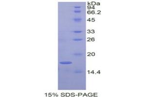 SDS-PAGE (SDS) image for Angiopoietin-Like 4 (ANGPTL4) (AA 286-409) protein (His tag) (ABIN1877495) (ANGPTL4 Protein (AA 286-409) (His tag))